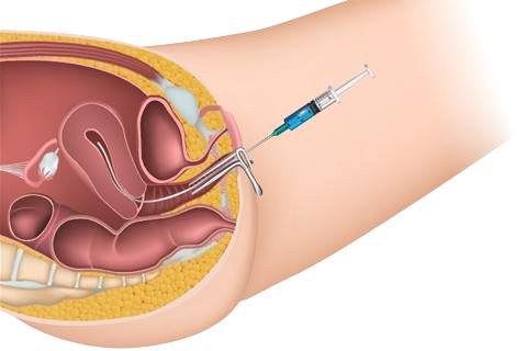 Spine Surgery